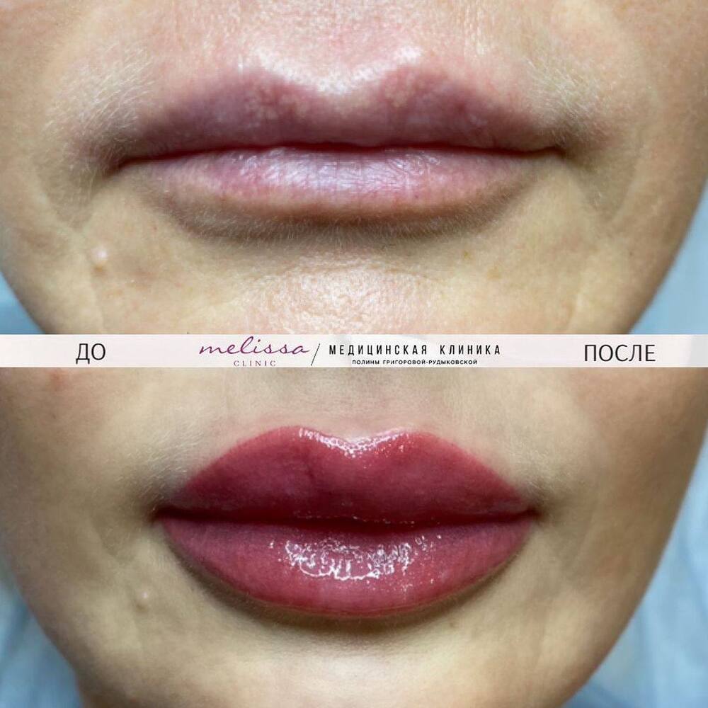 Перманентный макияж губ — фото 29.01.24 (1)